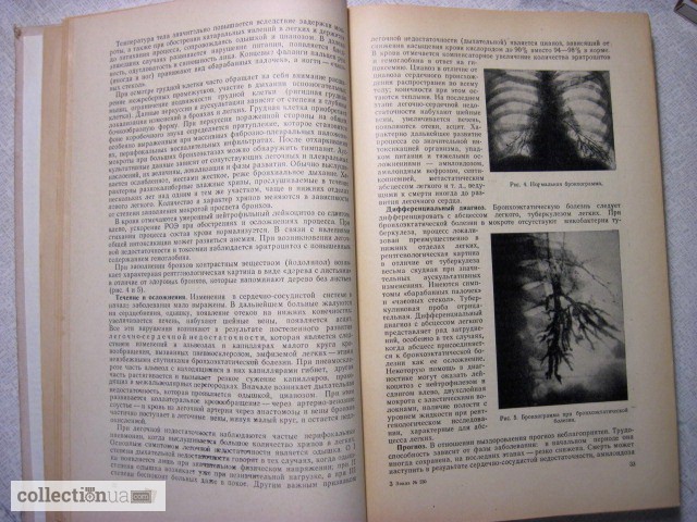 Фото 4. Гукасян А.Г. Внутренние болезни. 1972г. Учебник для студентов мединститута